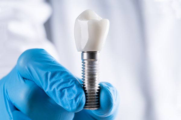 The Process Of Getting A Dental Implant From A Periodontist
