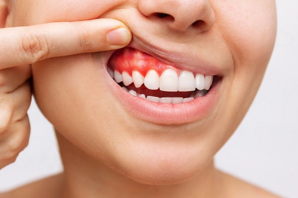 A Periodontist Describes Common Signs Of Gum Disease