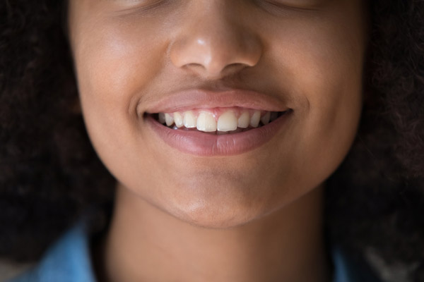 Treatment Options From A Periodontist For A Gummy Smile