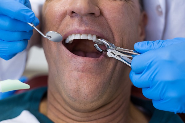When To See A Periodontist For A Tooth Extraction